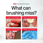 ID Stain Whitening Mouthwash